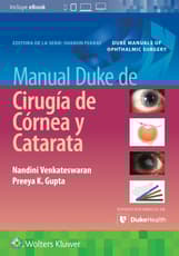 Manual Duke de cirugía de córnea y catarata