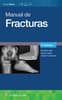 Manual de fracturas
