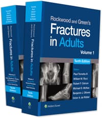 Rockwood and Green's Fractures in Adults: eBook with Multimedia