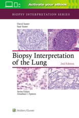 Biopsy Interpretation of the Lung