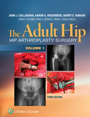 The Adult Hip