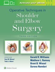 Operative Techniques in Shoulder and Elbow Surgery