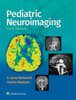 Pediatric Neuroimaging