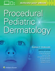 Procedural Pediatric Dermatology