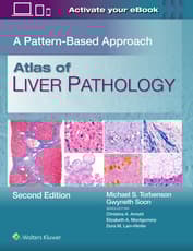 Atlas of Liver Pathology