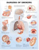 Dangers of Smoking Anatomical Chart
