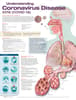 Understanding Coronavirus Disease 2019 (COVID-19) Anatomical Chart