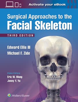 Surgical Approaches to the Facial Skeleton