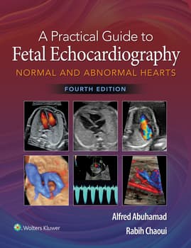 健康・医学 A Practical GuidetoFetalEchocardiography A Practical Guide to Fetal Echocardiography