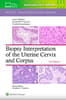 Biopsy Interpretation of the Uterine Cervix and Corpus: Print + eBook with Multimedia