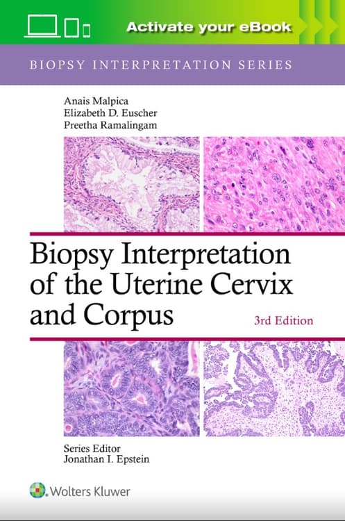 Biopsy Interpretation of the Uterine Cervix and Corpus: Print + eBook with Multimedia