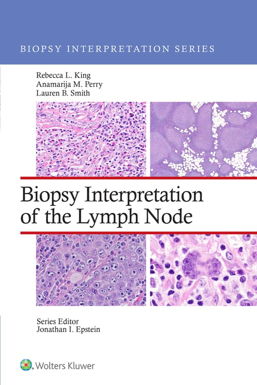 Biopsy Interpretation of the Lymph Node: eBook with Multimedia