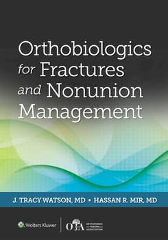 Orthobiologics for Fractures and Nonunion Management