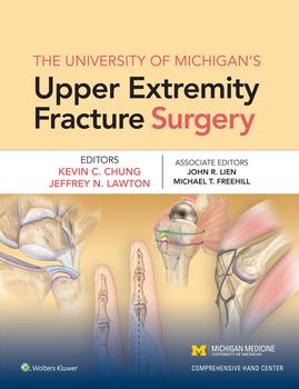 The University of Michigan's Upper Extremity Fracture Surgery