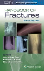 Handbook of Fractures