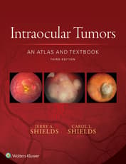 Intraocular Tumors: An Atlas and Textbook