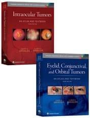 Shields: Intraocular Tumors 3e and Eyelid, Conjunctival, and Orbital Tumors 3e Package