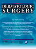 Dermatologic Surgery