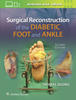 Surgical Reconstruction of the Diabetic Foot and Ankle