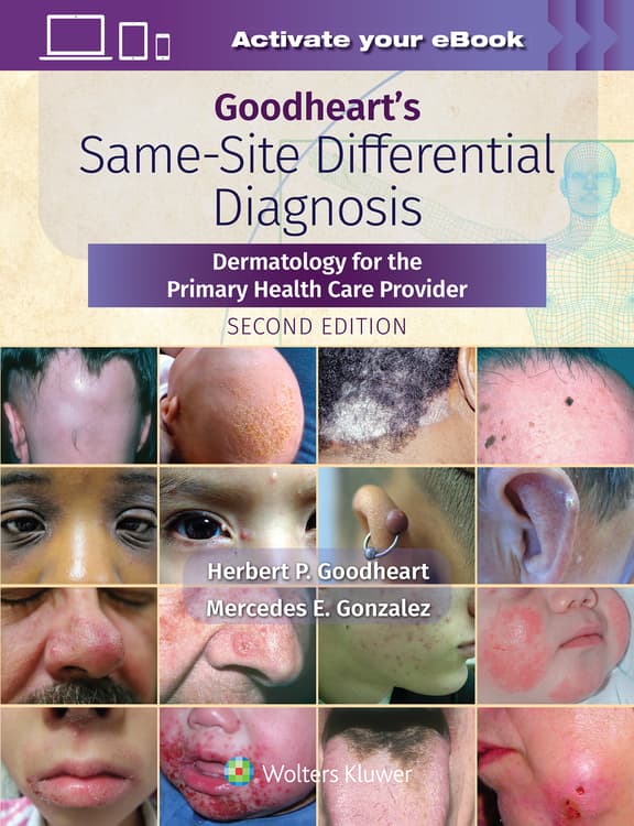 Goodheart's Same-Site Differential Diagnosis