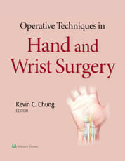 Operative Techniques in Hand and Wrist Surgery