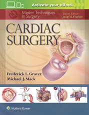 Cardiac Surgery