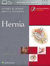 Master Techniques in Surgery: Hernia: Print + eBook with Multimedia