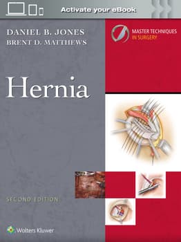 Master Techniques in Surgery: Hernia: Print + eBook with Multimedia