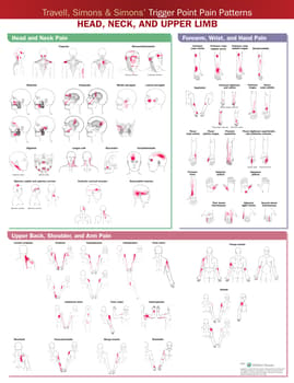 Travell, Simons & Simons’ Trigger Point Pain Patterns Wall Chart