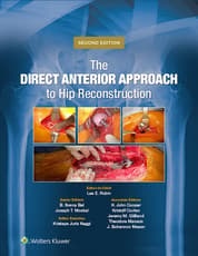 The Direct Anterior Approach to Hip Reconstruction