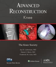 Advanced Reconstruction: Knee: Ebook without Multimedia