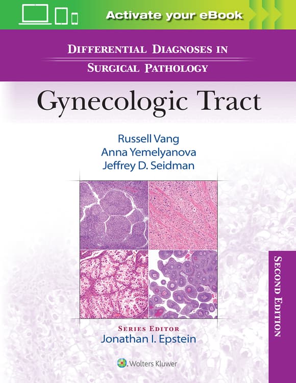 Differential Diagnoses in Surgical Pathology: Gynecologic Tract