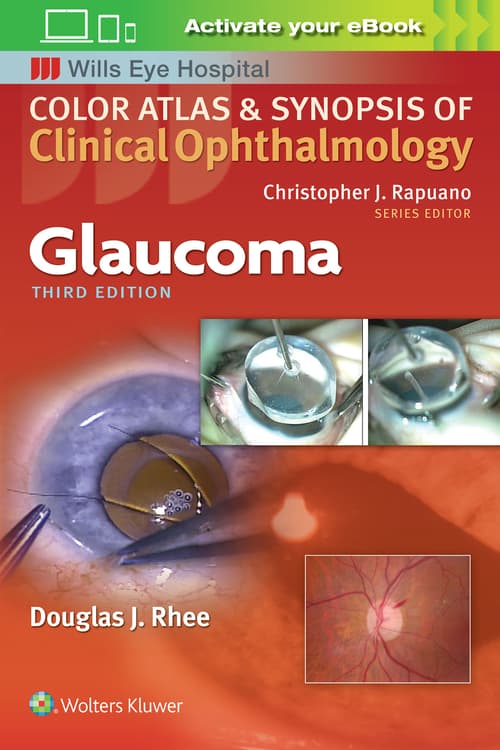 Glaucoma