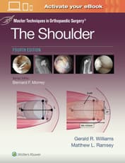 Master Techniques in Orthopaedic Surgery: The Shoulder: Print + eBook with Multimedia
