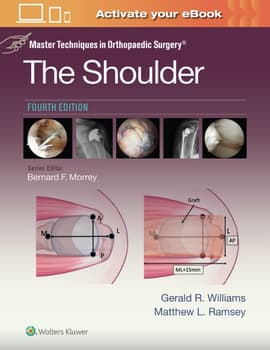 Master Techniques in Orthopaedic Surgery: The Shoulder