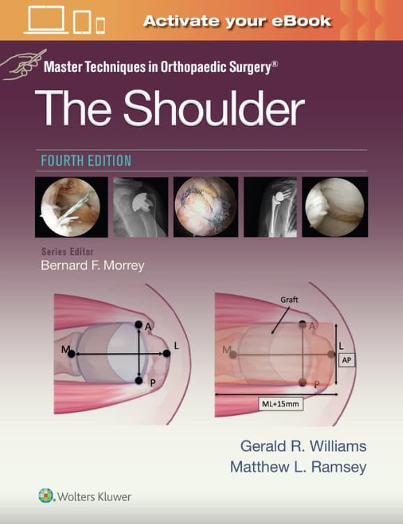Master Techniques in Orthopaedic Surgery: The Shoulder: Print + eBook with Multimedia