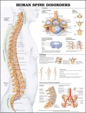 Human Spine Disorders Anatomical Chart