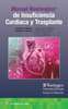 Manual Washington de insuficiencia cardiaca y trasplante