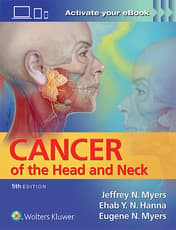 Cancer of the Head and Neck