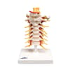 Flexible Cervical Vertebral Column