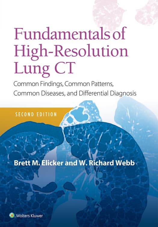 Fundamentals of High-Resolution Lung CT