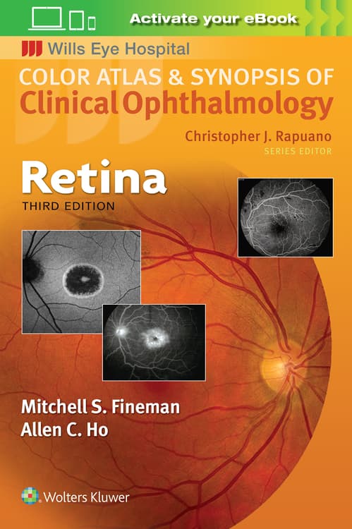 Retina