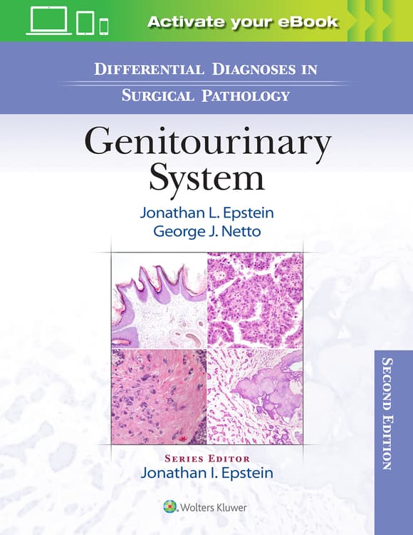 Differential Diagnoses in Surgical Pathology: Genitourinary System