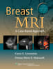 Breast MRI: A Practical Approach