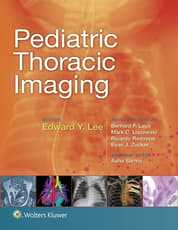 Pediatric Thoracic Imaging