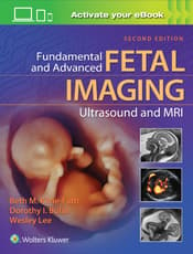 Fundamental and Advanced Fetal Imaging Ultrasound and MRI