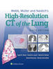 Webb, Müller and Naidich's High-Resolution CT of the Lung