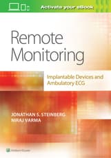 Remote Monitoring: implantable Devices and Ambulatory ECG