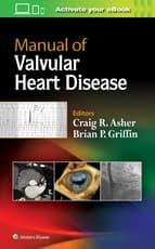 Manual of Valvular Heart Disease