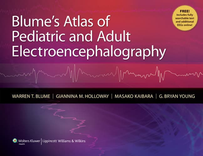 VitalSource E-Book for Blume's Atlas of Pediatric and Adult Electroencephalography